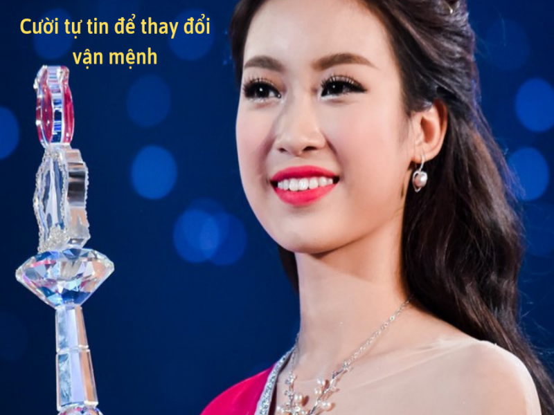 Nha Khoa Hoàn Mỹ - 94 Nguyễn Công Trứ, TP. Bảo Lộc
